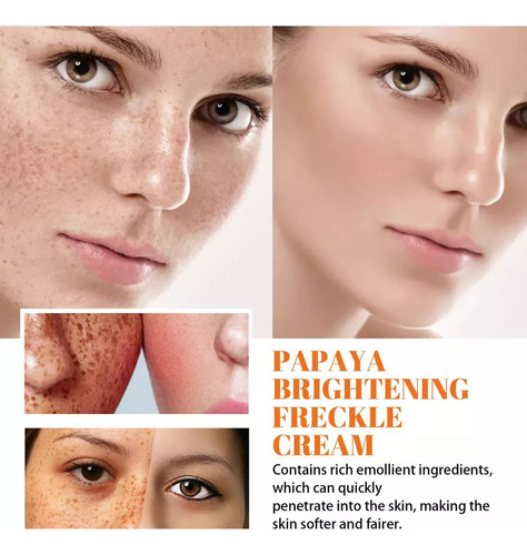 - Crema Blanqueadora, Aclaradora Y Eliminadora De Pecas