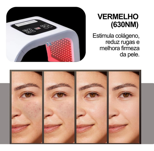 Cabine Cromoterapia Led 7 Cores Tratamento Terapia Facial Instrumento De Beleza De Espectro Colorido Remoção De Acne E Rejuvenescimento Da Pele Com Tecnologia De Fóton Mais Branco Para Sardas