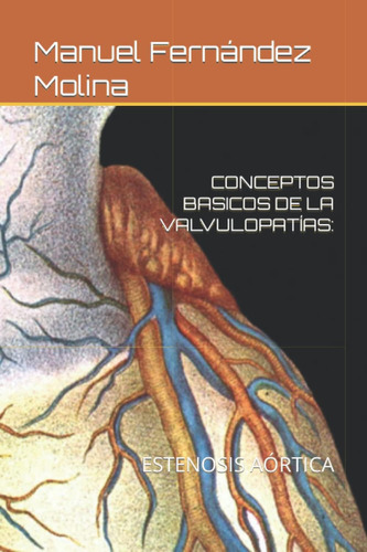 Libro: Conceptos Basicos De Las Valvulopatías:: Estenosis Aó