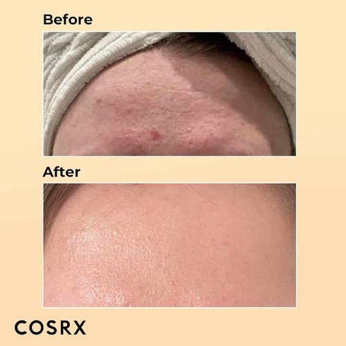 Cosrx - Serum Rostro Advanced Con Esencia De Mucina Tipo de piel TendenciaAcnéica