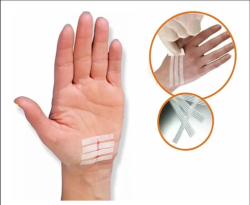 Sutura Cutânea Ponto Falso Kelogel Strip 12mmx100mm 120un