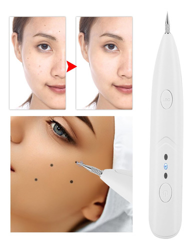 Lapiz Facial Eliminador Removedor Manchas Pecas Verrugas