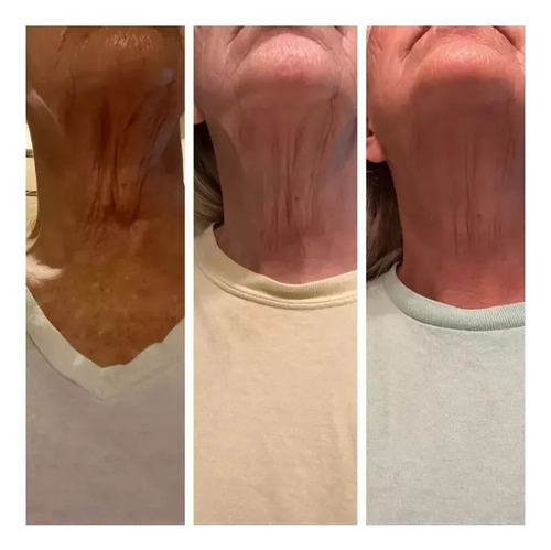 Crema For El Cuello Gopure - Crema Reafirmante For El