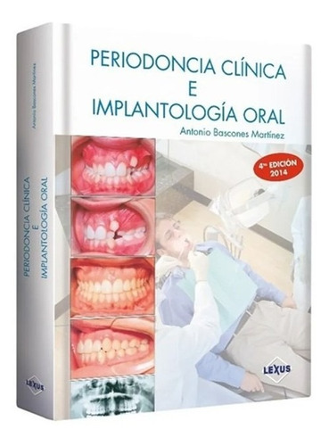 Libro Periodoncia Clínica  E Implantologia Oral 4ta Edición 