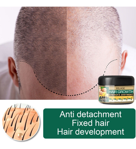 Xinnuo 120ml Aceite Jengibre Denso Crema Crecimiento Cabello