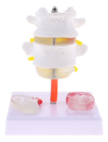 Vértebra Lombar Da Coluna Vertebral Humana 1: 1 Com Modelo