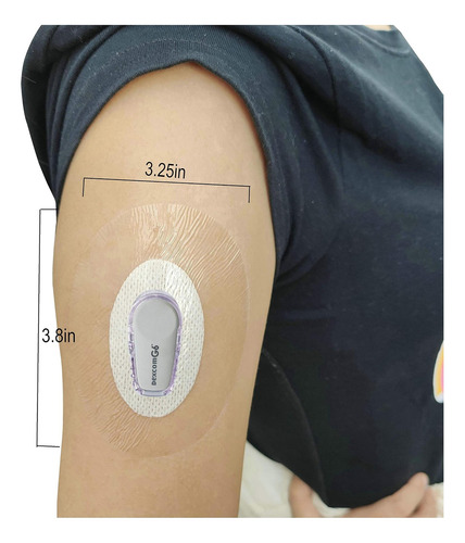 Parches Cgm De Hibell 25pcs Para Dexcom G6, Parches Previos,