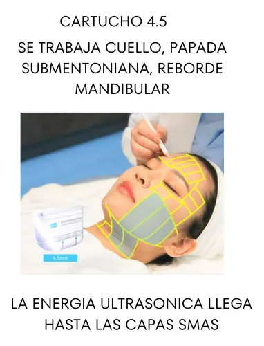 Alquiler Aparatologia Hifu 8d Adss Lifting Sin Cirugia