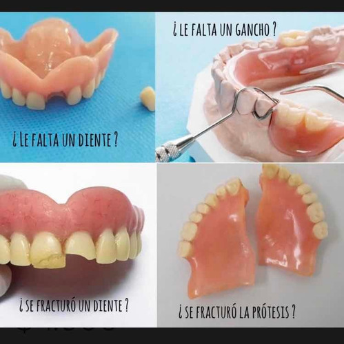 Imagen 2 de 5 de Reparación De Prótesis En El Acto!