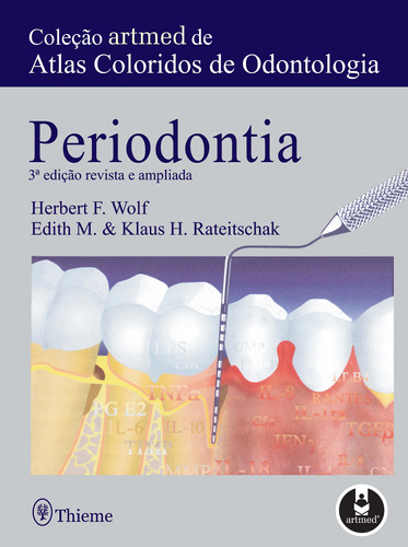 Periodontia: Coleção Artmed de Atlas Coloridos de Odontologia, de Wolf, Herbert F. Artmed Editora Ltda., capa mole em português, 2006