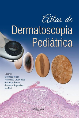 Livro: Atlas De Dermatoscopia Pediatrica