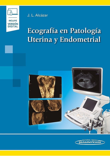 Ecografía En Patología Uterina Y Endometrial Autor: Alcazar