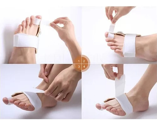 Corrector Juanete 2 Férulas Hallux Valgus