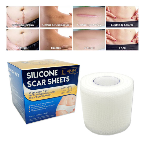 Parche Silicona Reutilizable Cicatrices Scar Sheets 3m 300cm