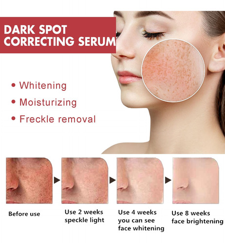 Suero Corrector De Manchas Oscuras Con Niacinamida