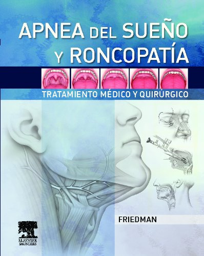 Libro Apnea Del Sueño Y Roncopatía De M. Friedman Elsevier