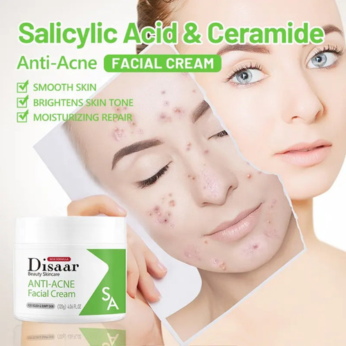 Crema Facial Anti-acné, Ácido Salicílico, Aclara Y Repara Grasa Y Mixta Día/noche