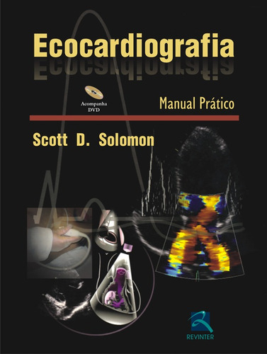 Ecocardiografia: Manual Prático, de Solomon, Scott D.. Editora Thieme Revinter Publicações Ltda, capa dura em português, 2015