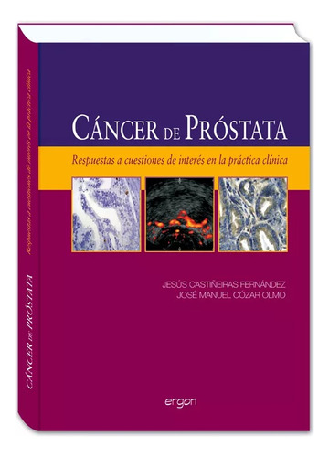 Libro Cáncer De Próstata Respuestas A Cuestiones De Interés