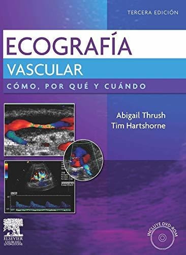 Libro Ecografia Vascular C/dvd Rom