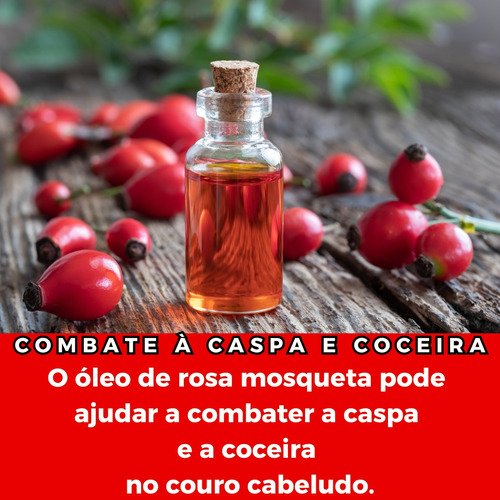 Kit 5 Un Rosa Mosqueta Serum Capilar E Corporal Natural 30ml