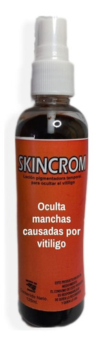 Oculta El Vitiligo. Un Frasco. No Dermacrom No Tono Naranja