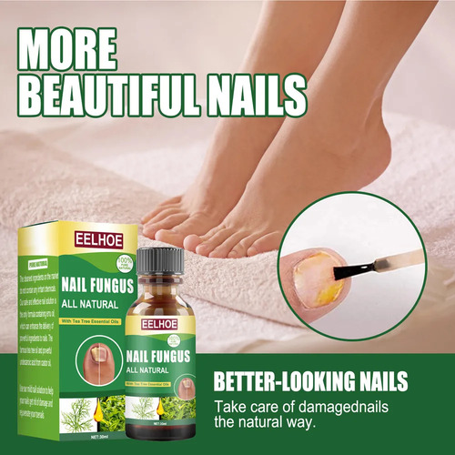 Esmalte De Uñas 3toe: Solución Para El Cuidado De Hongos-