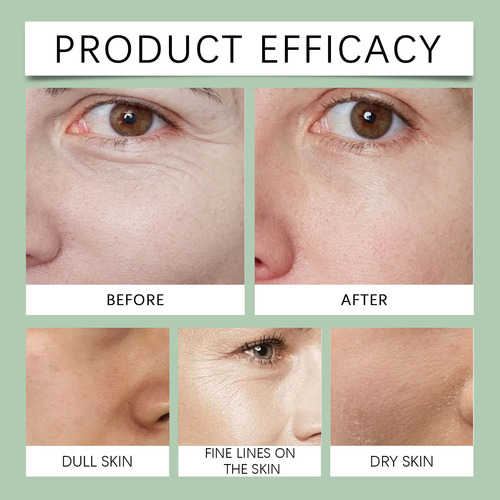 Crema Facial Reafirmante E Hidratante Activadora D Contai 30