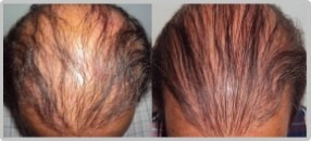 Tratamiento Para La Caida Del Cabello, C - mL a $90
