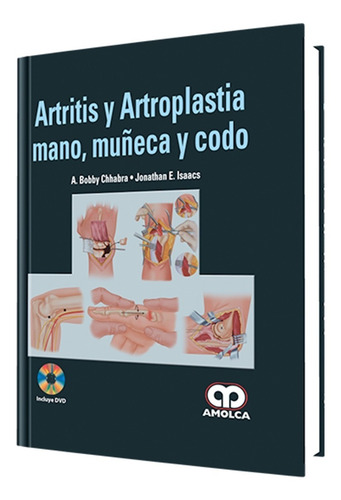 Artritis Y Artroplastia. Mano, Muñeca Y Codo. Libro Amolca