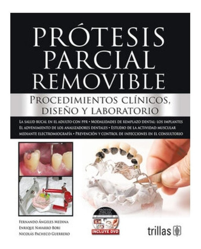Protesis Parcial Removible. Incluye Dvd Libro Trs