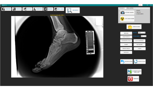 Radiografia Digital Directa Veterinaria Rayos X