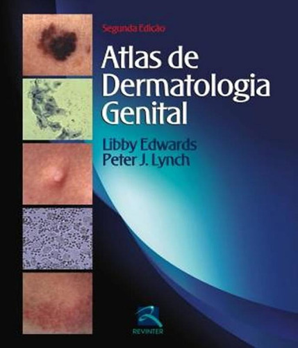 Livro - Atlas De Dermatologia Genital - Edwards
