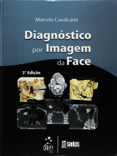 Diagnóstico por Imagem da Face, de Cavalcanti. Livraria Santos Editora Comércio e Importação Ltda., capa mole em português, 2012