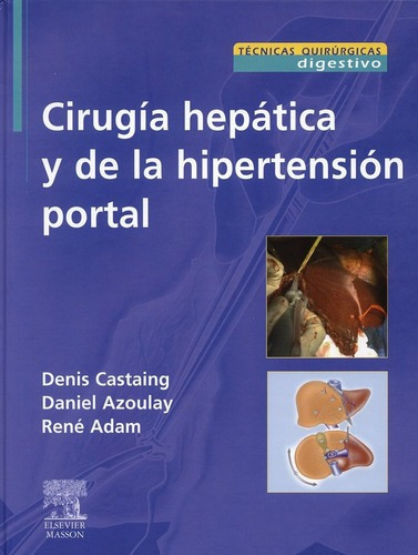 Cirugia Hepatica Y De La Hipertension Portal, De Castaing. Editorial Elsevier En Español