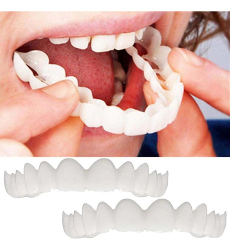 Restauración Temporal De Dentaduras Postizas, Dientes De Cha