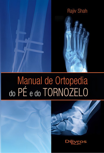 Livro: Manual De Ortopedia Do Pe E Do Tornozelo