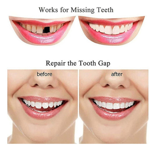 Las Dentaduras Postizas Heolien Te Hacen Sonreír
