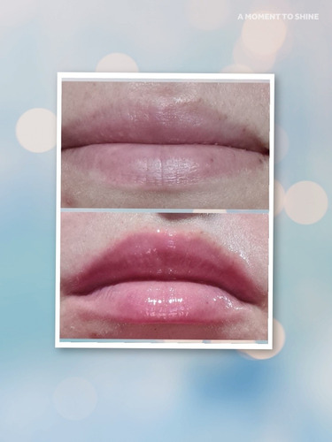 Imagem 1 de 1 de Hydra Gloss Lips