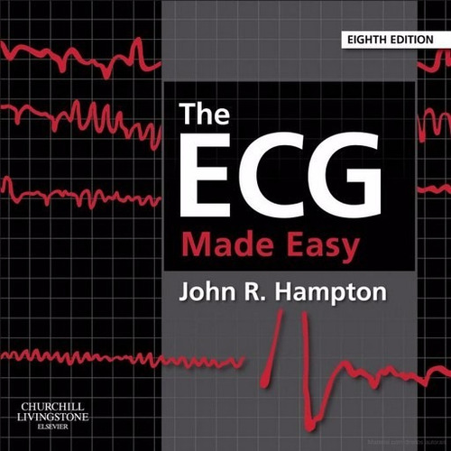 Livro Descomplicando O Eletrocardiograma O Ecg Fácil