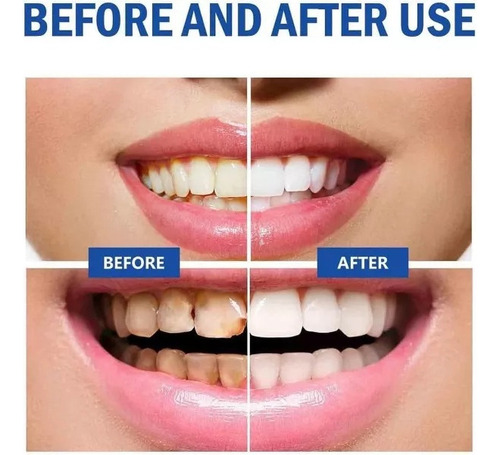 3x Pasta Dientes Probiótica Sp-10 Para Blanquear Los Dientes