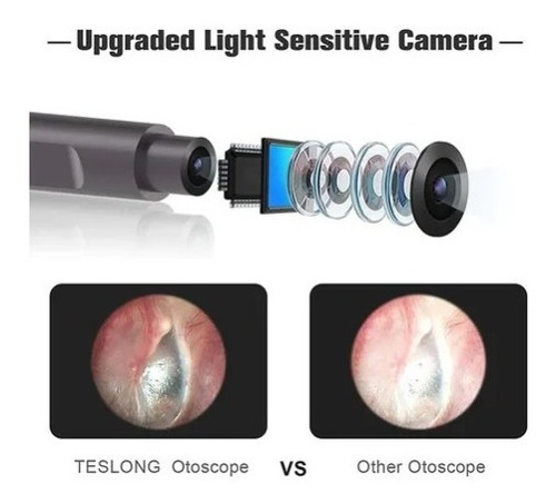 Otoscopio Digital, Videotoscopio Con Removedor De Cera