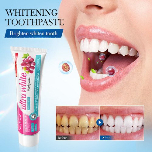 Pasta De Dientes No Blanqueadora Y Quitamanchas Oral White T
