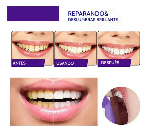 E Pasta Dentífrica Blanqueadora/reparadora Hi-smile V34 *2