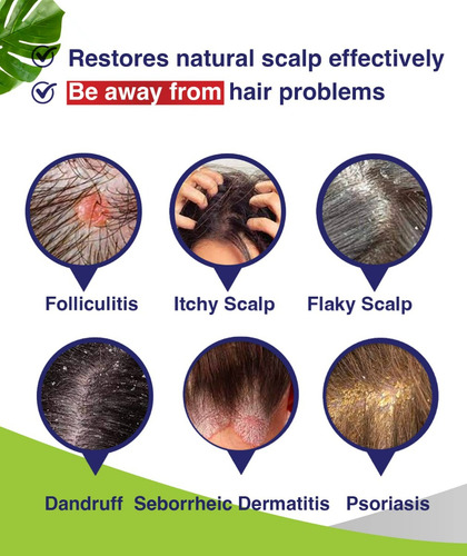 Pharmbanner Foliculitis, Champú Para Dermatitis Seborreica