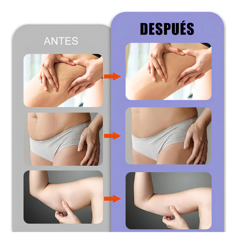 Masajeador Facial Portátil Para Belleza R F 4 Luces Ems 4en1