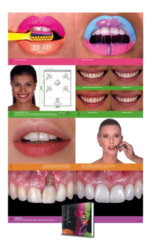 Livro Odontologico Estética 4 Tops - Dudu Medeiros