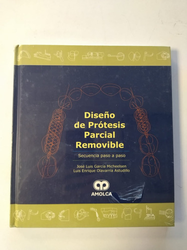 Libro - Diseño De Protesis Parcial Removible
