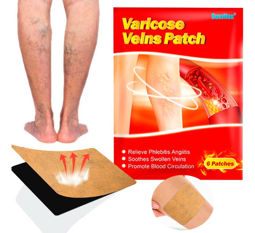 Parches Magico Vasculitis Dolor Muscular Artritico Varices Color Rojo