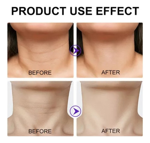 -- Crema Reafirmante For El Cuello Gopure, (2 Unidades)